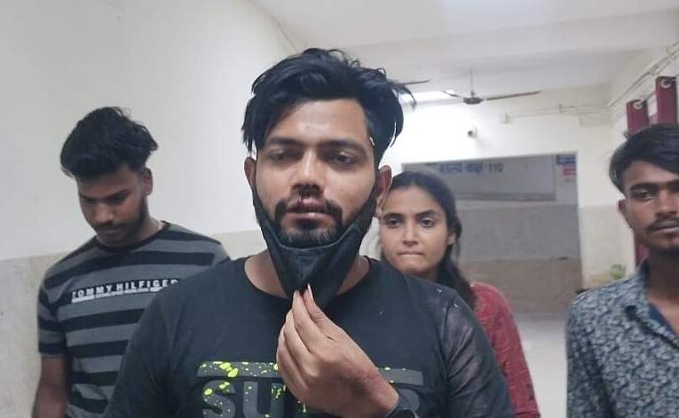 Bokaro: जमीन विवाद में चली गोली व चाकू, दो युवक घायल, पुलिस मामले की रही जांच